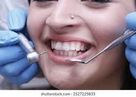 Smile Makeover (Orthodontic)